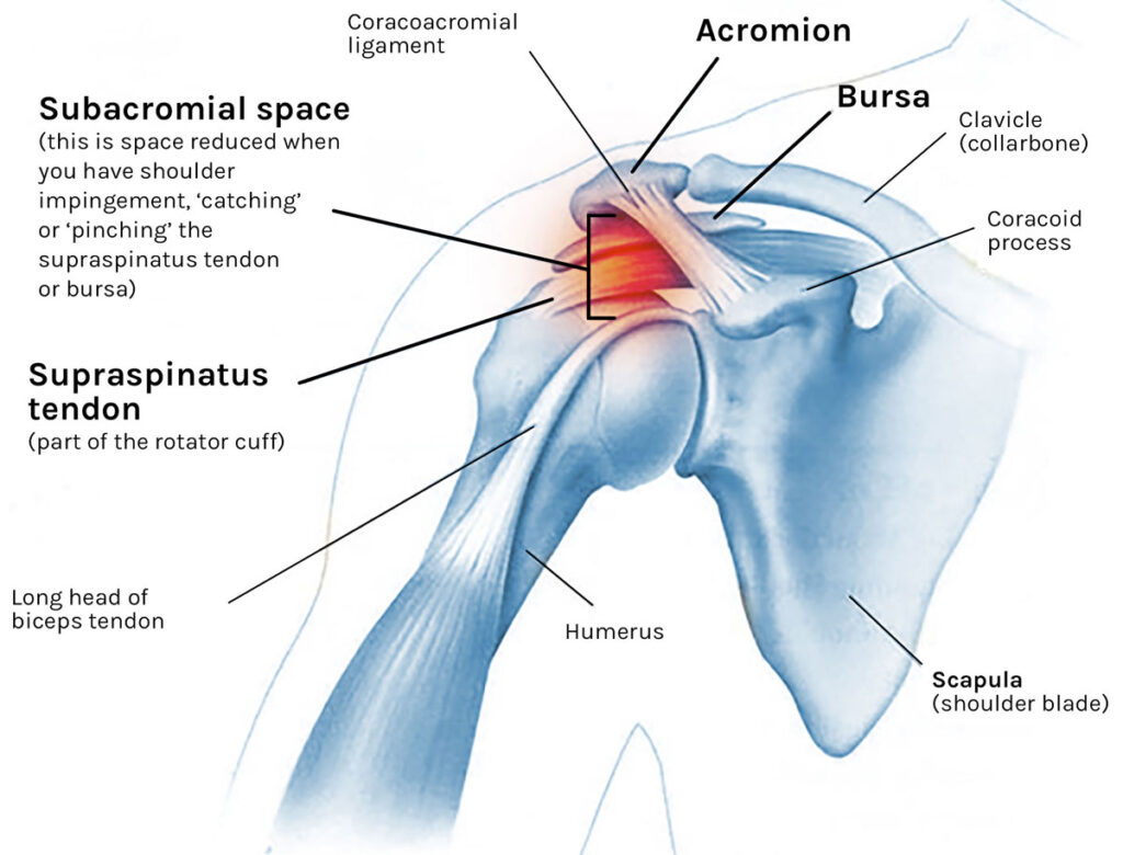 Of The Best Shoulder Impingement Exercises And Stretches Health Blog