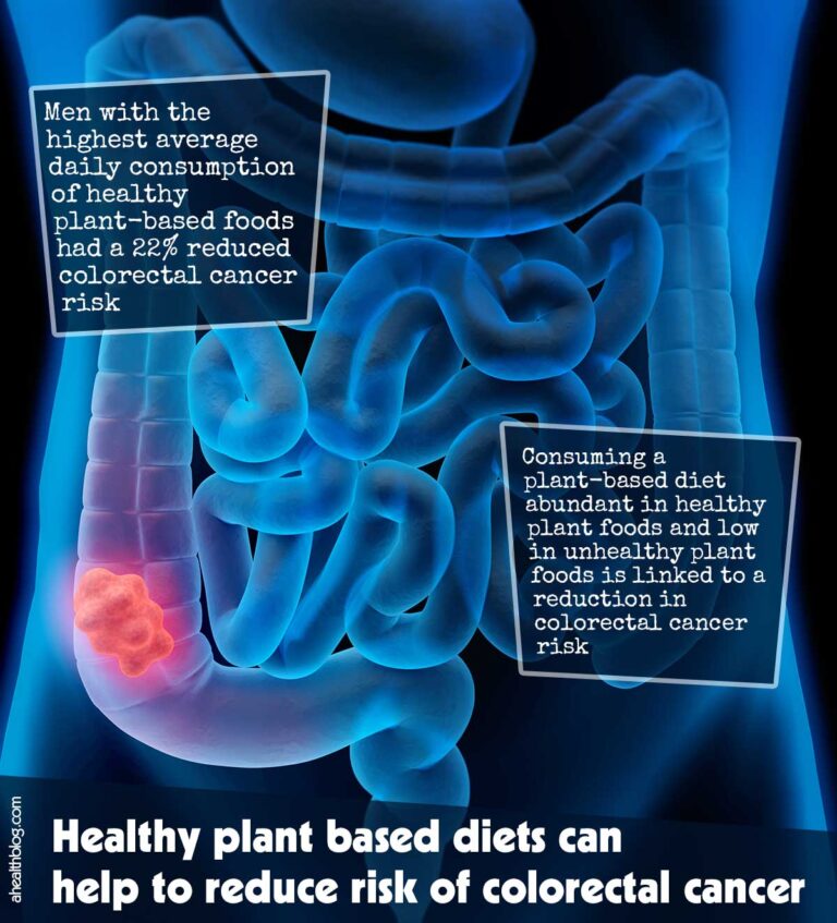 healthy-plant-based-diets-can-help-to-reduce-risk-of-colorectal-cancer