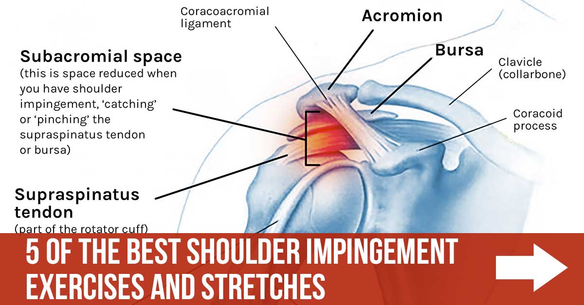 5 Of The Best Shoulder Impingement Exercises And Stretches