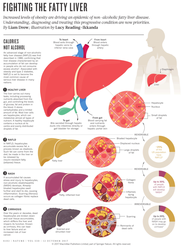 High Intensity Interval Training May Help Improve Health of the Liver